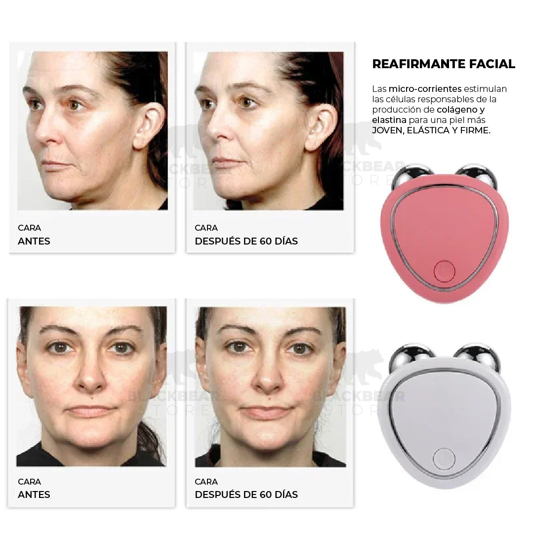 Masajeador Facial Eléctrico - VitaPulse™